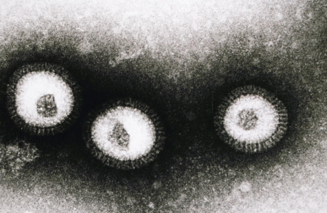 photo de microscopie du virus influenza